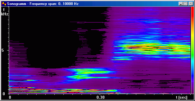 Sonogram